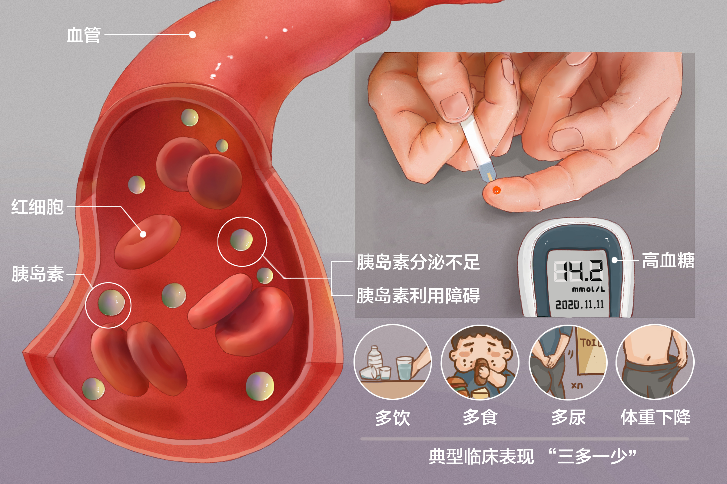 2024年糖尿病患者占比